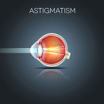 Chart Showing How Astigmatism Affects an Eye